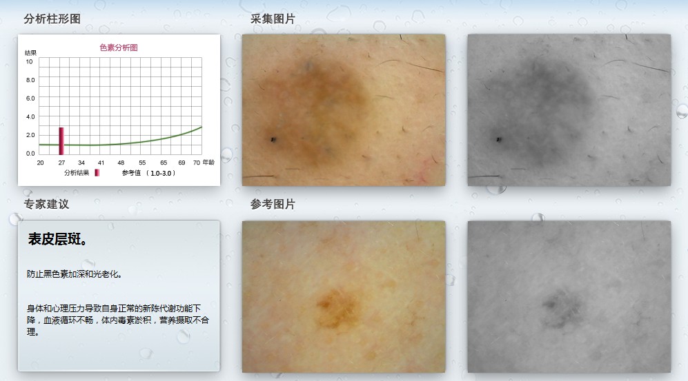 皮膚測試儀 科學護膚的智能助手