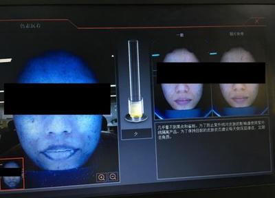皮膚檢測(cè)儀深度實(shí)測(cè) Visia、美圖宜膚、A-one究竟哪家強(qiáng)？